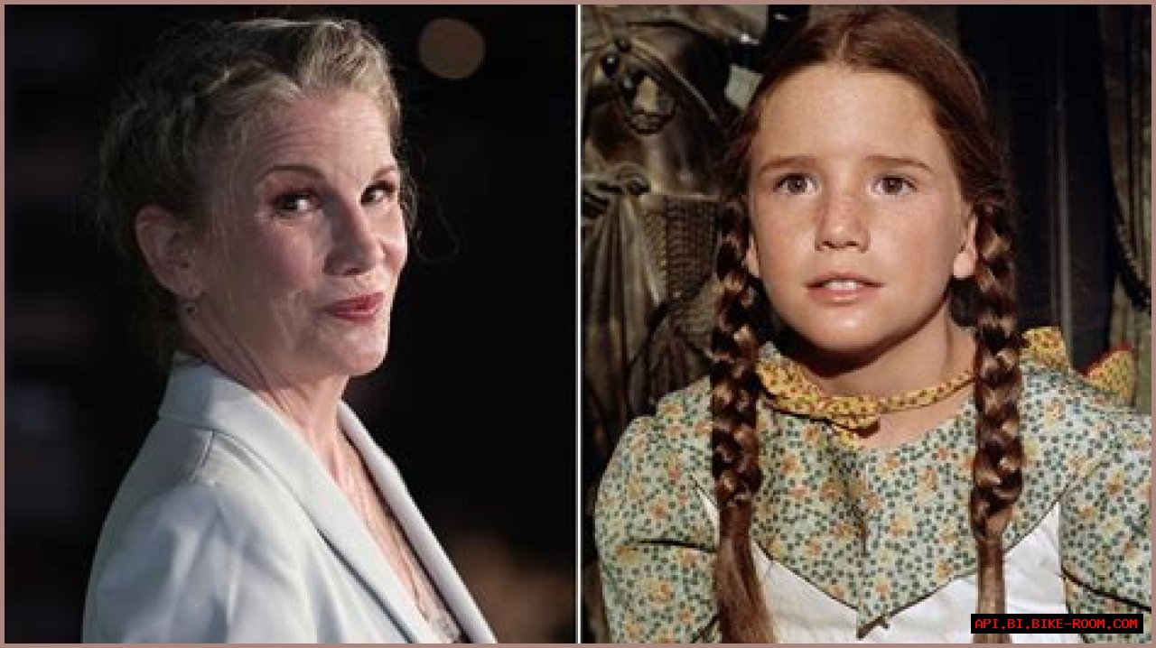 Unveiling Melissa Gilbert's Plastic Surgery Journey: Discoveries And Insights